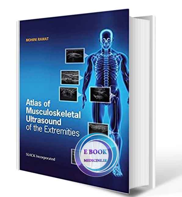 دانلود کتاب Atlas of Musculoskeletal Ultrasound of the Extremities 1st 2020 (ORIGINAL PDF)